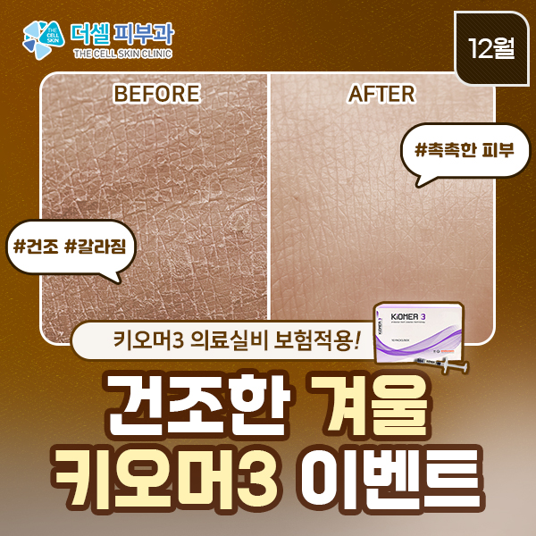 모바일