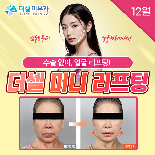 모바일