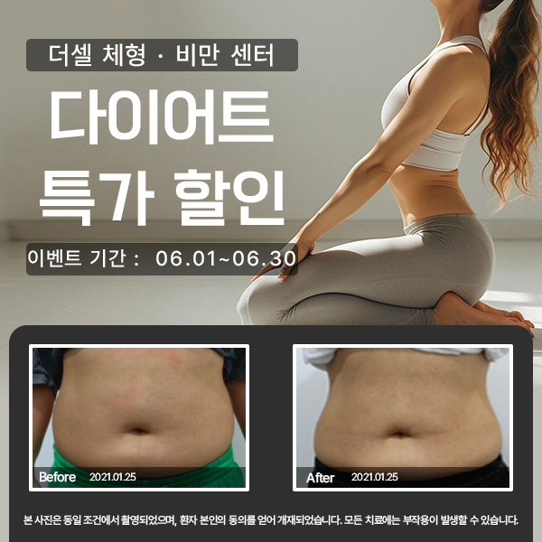 모바일